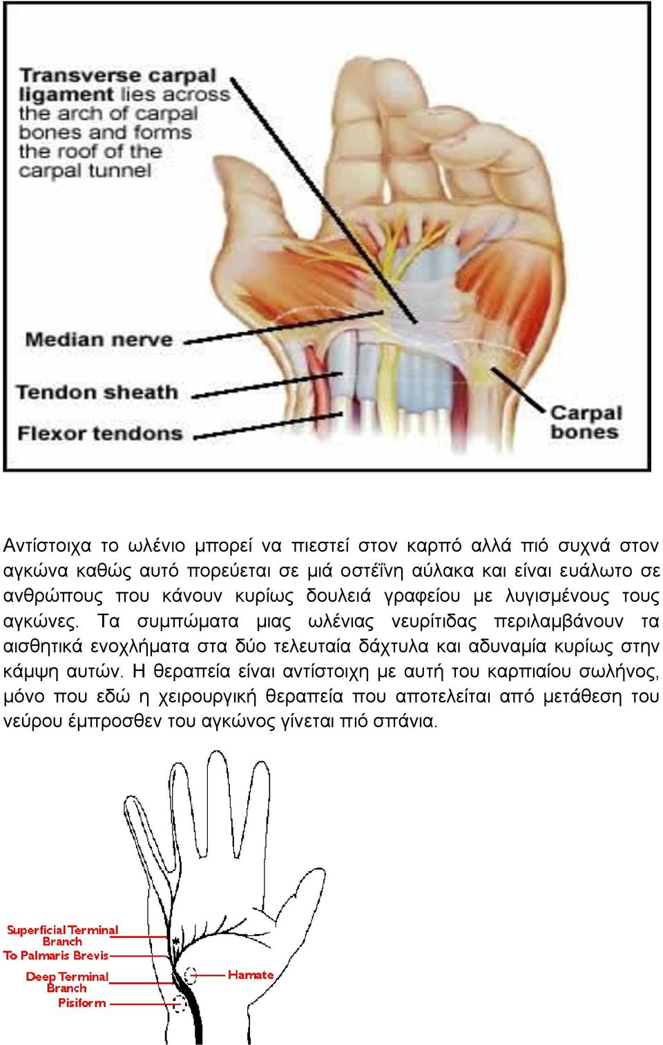 Τα συμπώματα μιας ωλένιας νευρίτιδας περιλαμβάνουν τα αισθητικά ενοχλήματα στα δύο τελευταία δάχτυλα και αδυναμία κυρίως στην κάμψη