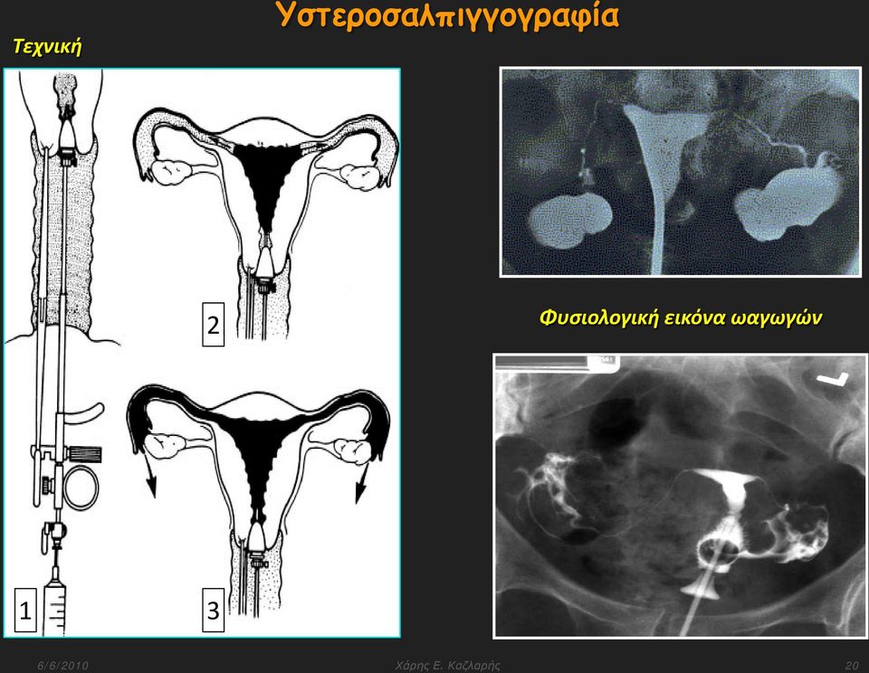 Φυσιολογική εικόνα