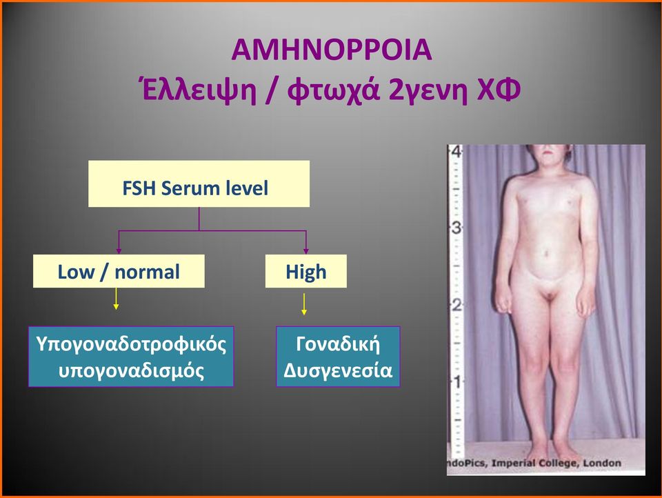 normal High Υπογοναδοτροφικός