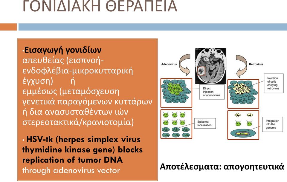 ιών στερεοτακτικά/κρανιοτομία) HSV-tk (herpes simplex virus thymidine kinase gene)