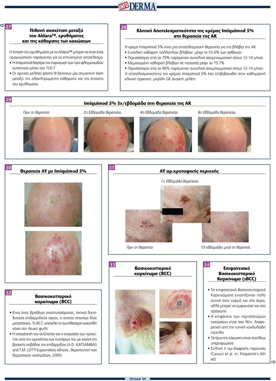 28 Κλινική Αποτελεσματικότητα της κρέμας Imiquimod 5% στη θεραπεία της ΑΚ Η κρέμα Imiquimod 5% είναι μία αποτελεσματική θεραπεία για της βλάβες της AK Συνολική κάθαρση πολλαπλών βλαβών: μέχρι το 55.