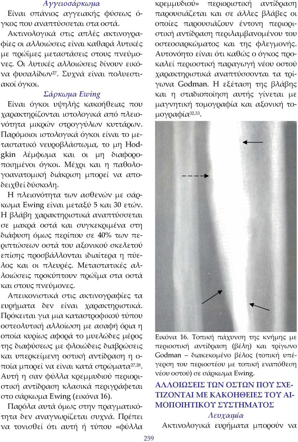 Παρόμοιοι ιστολογικά όγκοι είναι το μεταστατικό νευροβλάστωμα, το μη Hodgkin λέμφωμα και οι μη διαφοροποιημένοι όγκοι. Μέχρι και η παθολογοανατομική διάκριση μπορεί να αποδειχθεί δύσκολη.