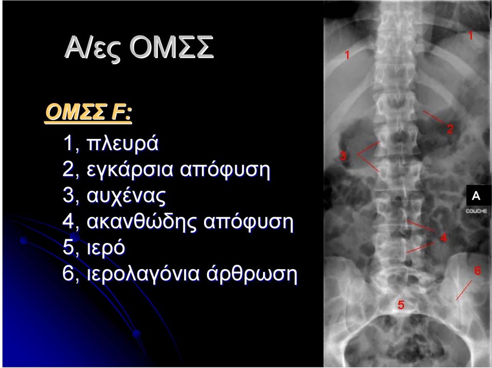 αυχένας 4, ακανθώδης