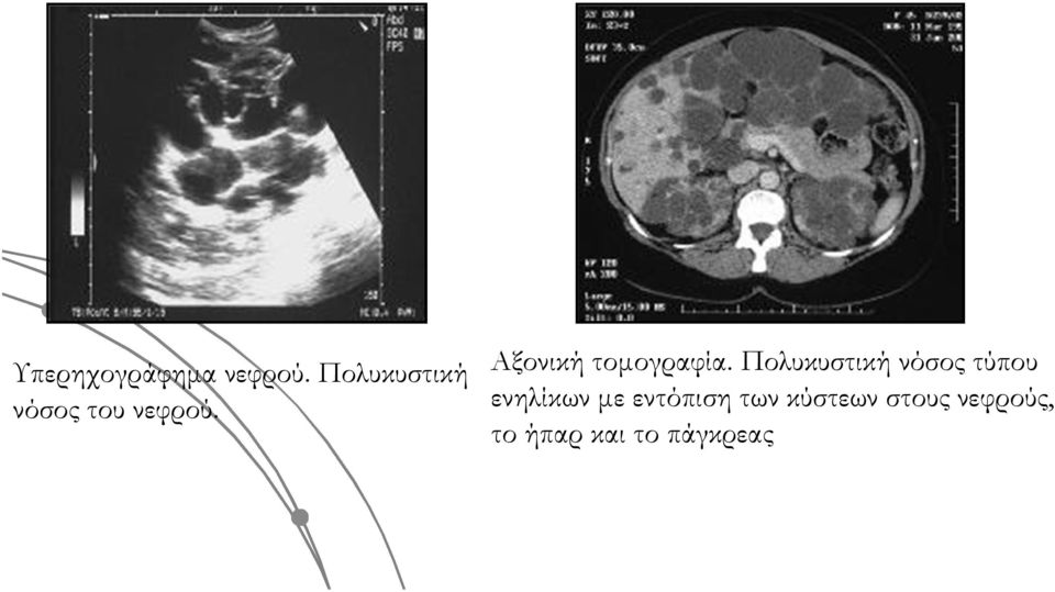 Αξονική τομογραφία.