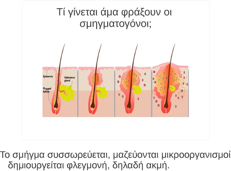 συσσωρεύεται, μαζεύονται