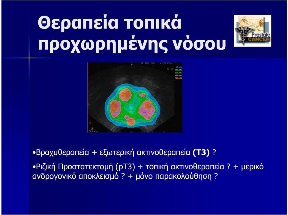 Ριζική Προστατεκτοµή (pt3) + τοπική