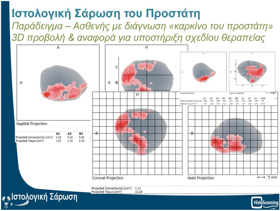 προστάτη» 3D προβολή &