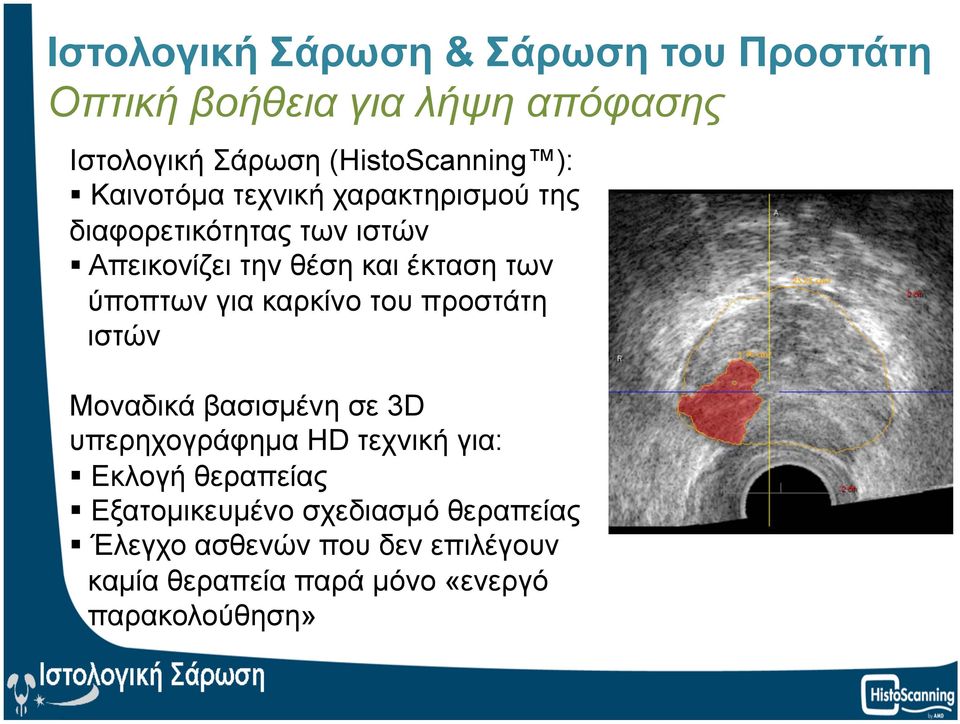 για καρκίνο του προστάτη ιστών Mοναδικά βασισµένη σε 3D υπερηχογράφηµα HD τεχνική για: Eκλογή θεραπείας