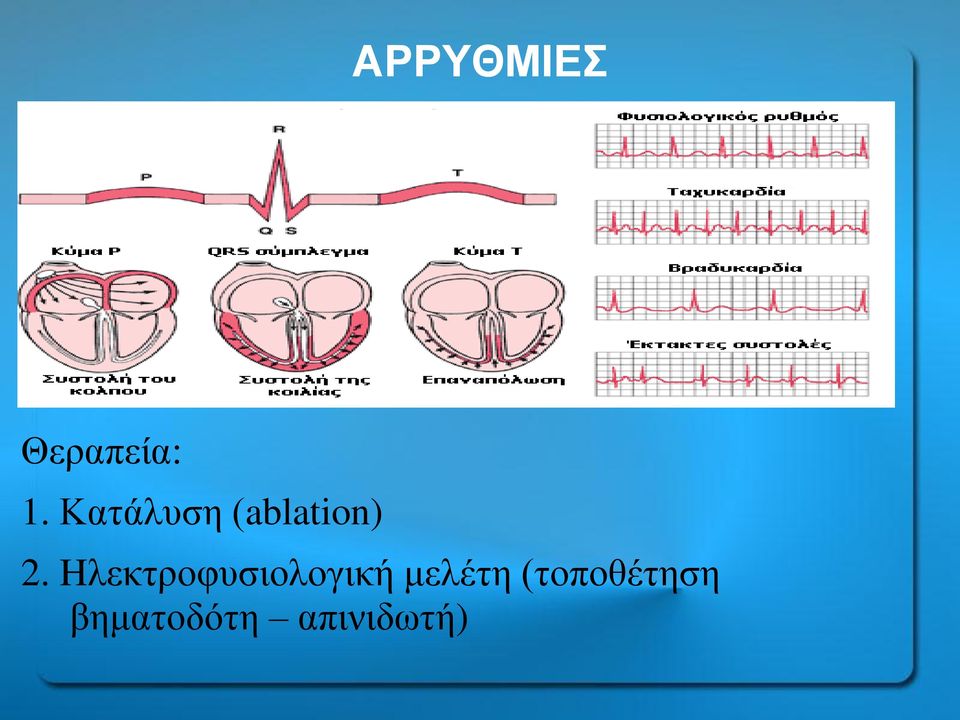 Hλεκτροφυσιολογική μελέτη