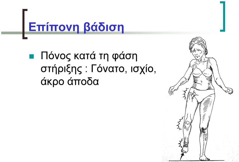 φάση στήριξης :