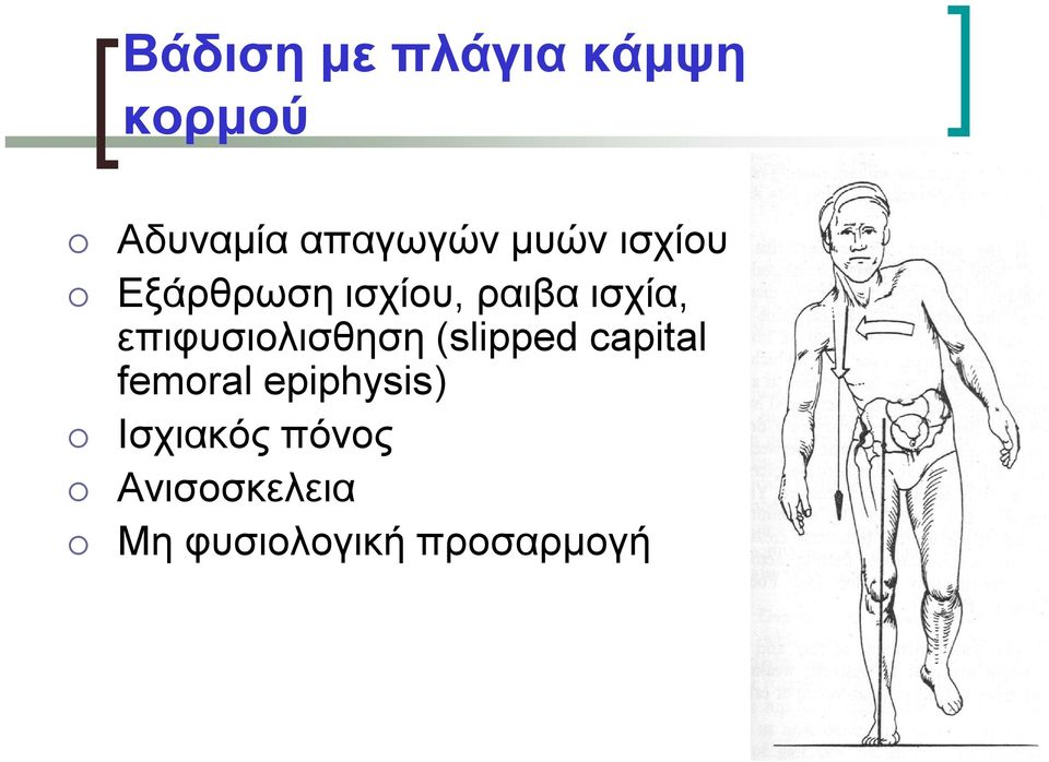 επιφυσιολισθηση (slipped capital femoral