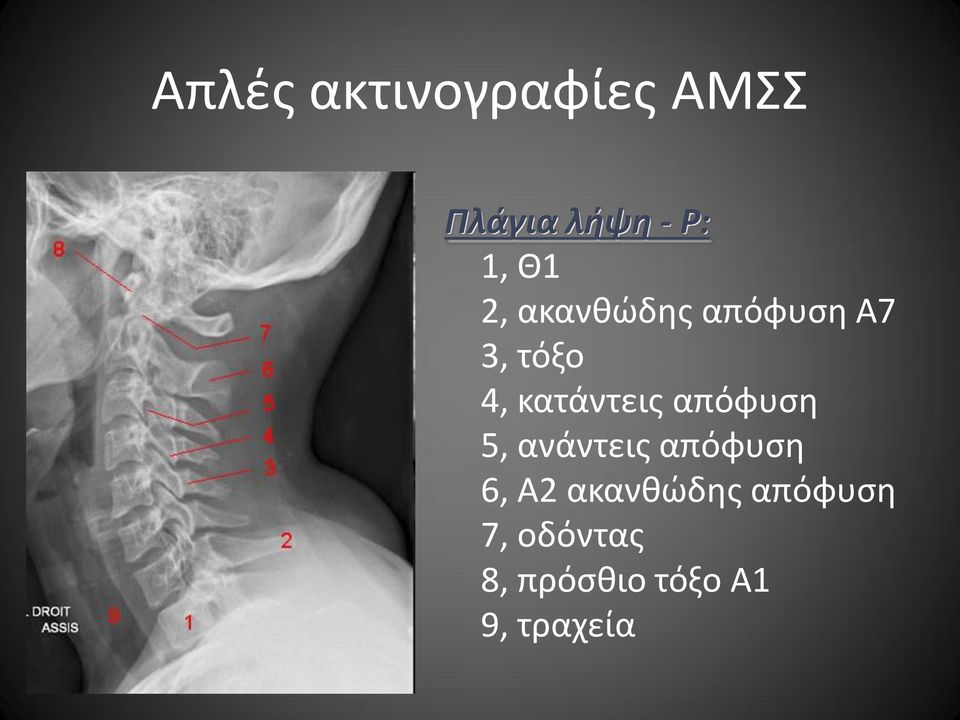 κατάντεις απόφυση 5, ανάντεις απόφυση 6, Α2