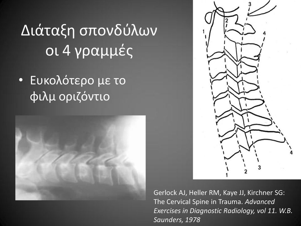 SG: The Cervical Spine in Trauma.