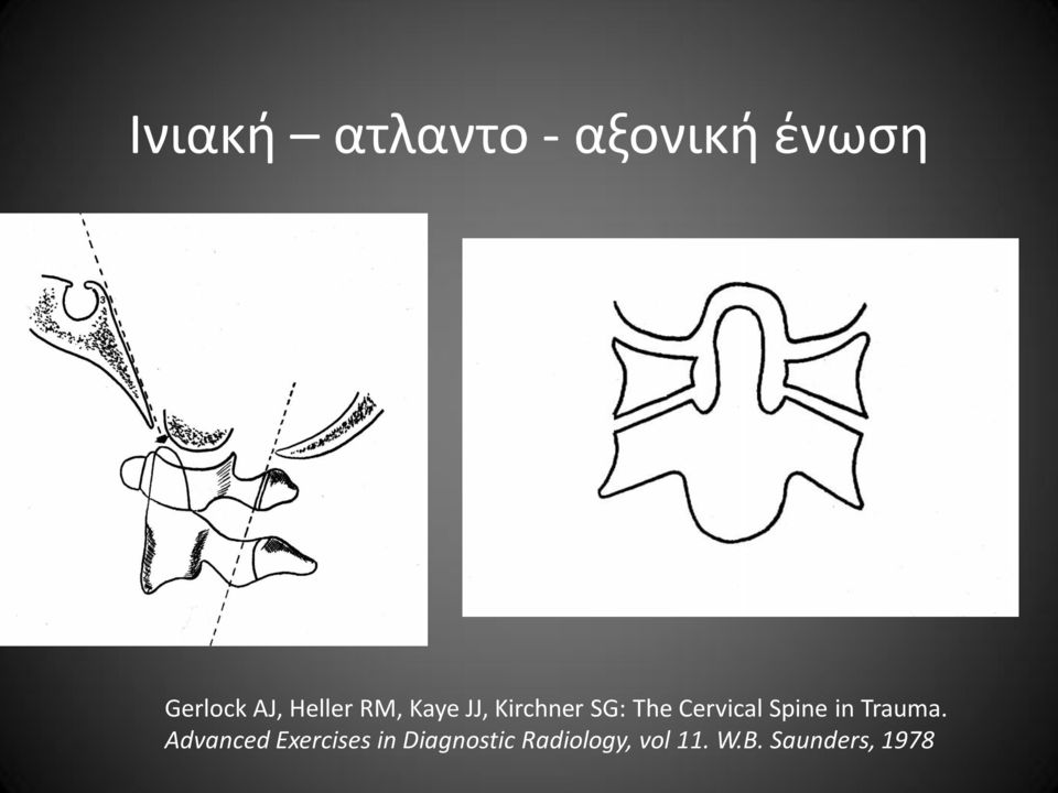 Cervical Spine in Trauma.