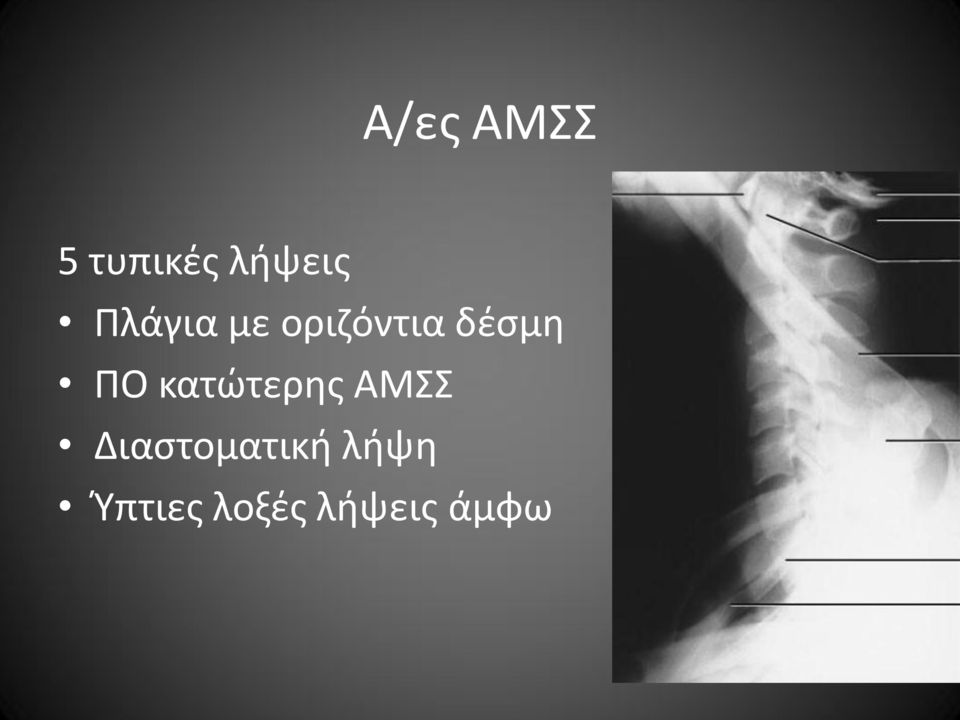 κατώτερης ΑΜΣΣ Διαστοματική