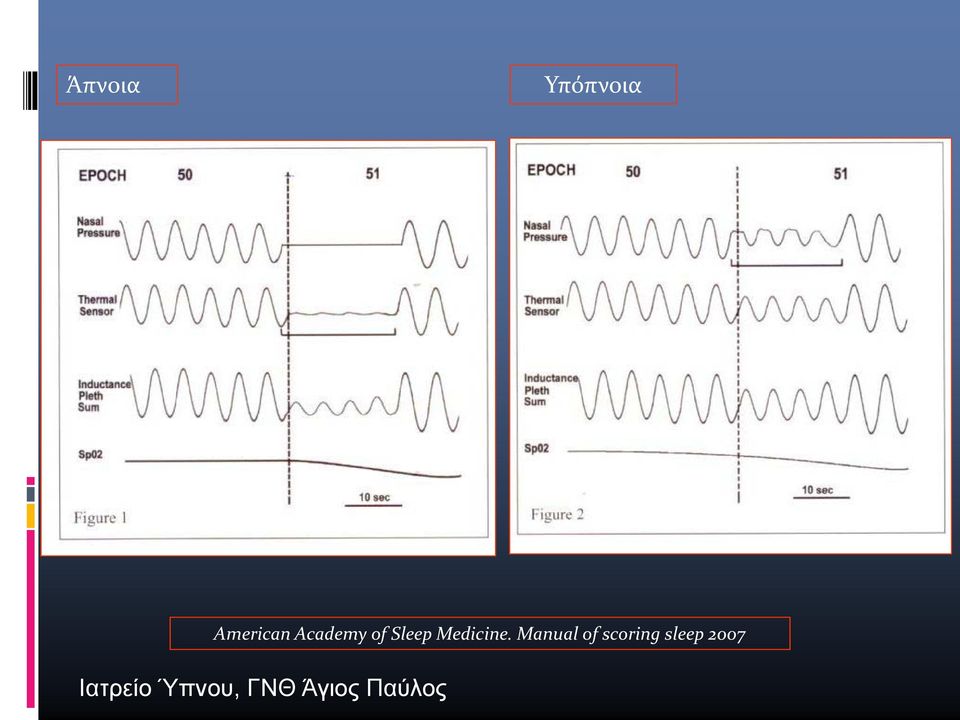 Manual of scoring sleep