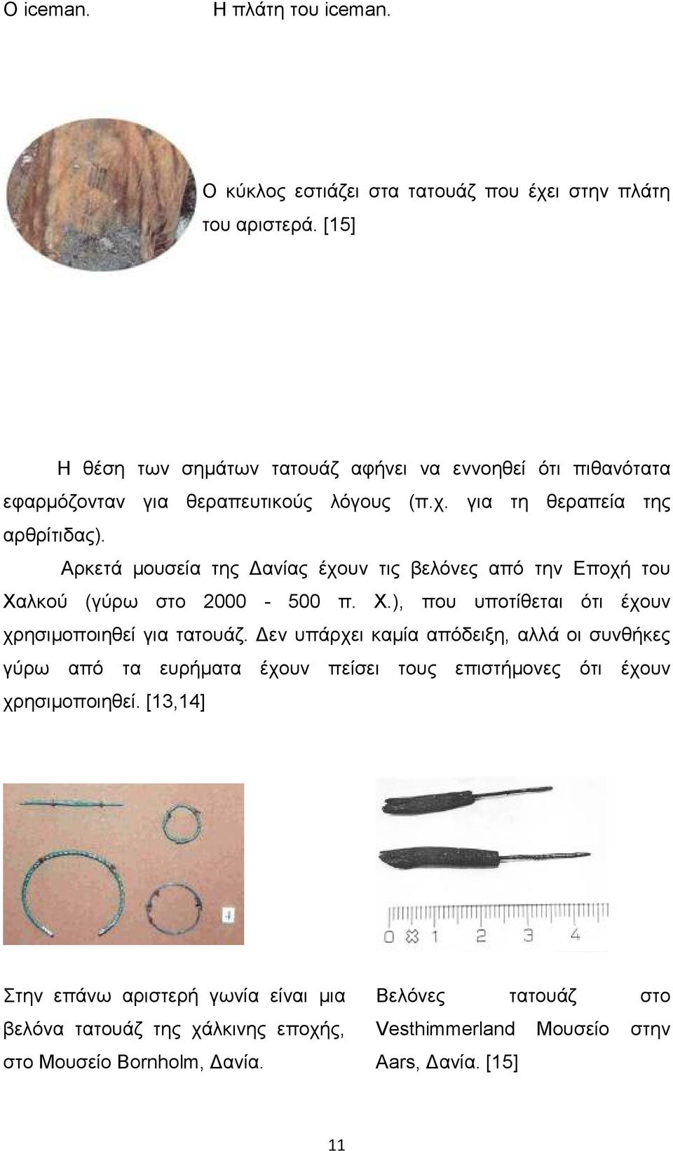 Αρκετά µουσεία της ανίας έχουν τις βελόνες από την Εποχή του Χαλκού (γύρω στο 2000-500 π. Χ.), που υποτίθεται ότι έχουν χρησιµοποιηθεί για τατουάζ.