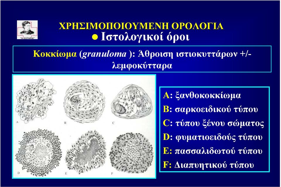 ξανθοκοκκίωµα Β: σαρκοειδικού τύπου C: τύπου ξένου