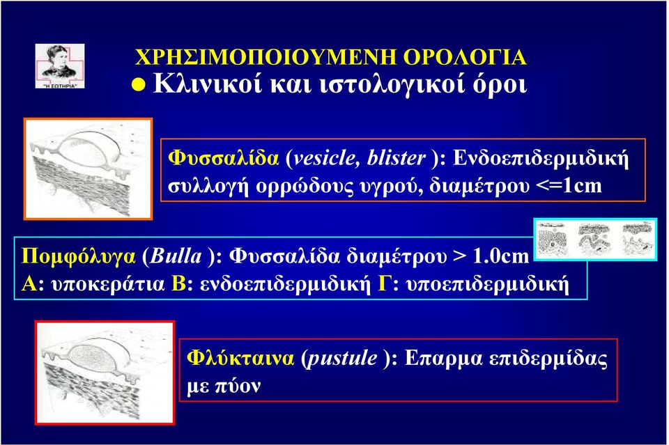 <=1cm Ποµφόλυγα (Bulla ): Φυσσαλίδα διαµέτρου > 1.