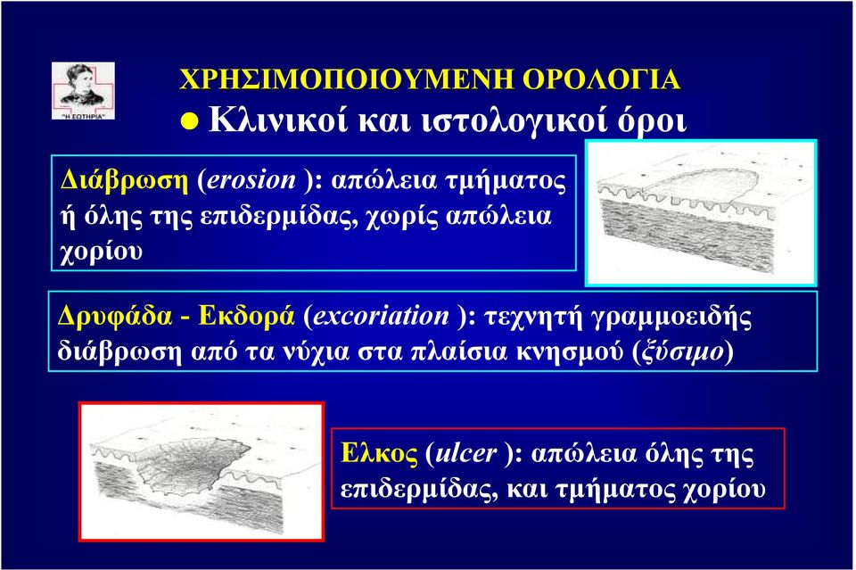 Εκδορά (excoriation ): τεχνητή γραµµοειδής διάβρωση από τα νύχια στα πλαίσια