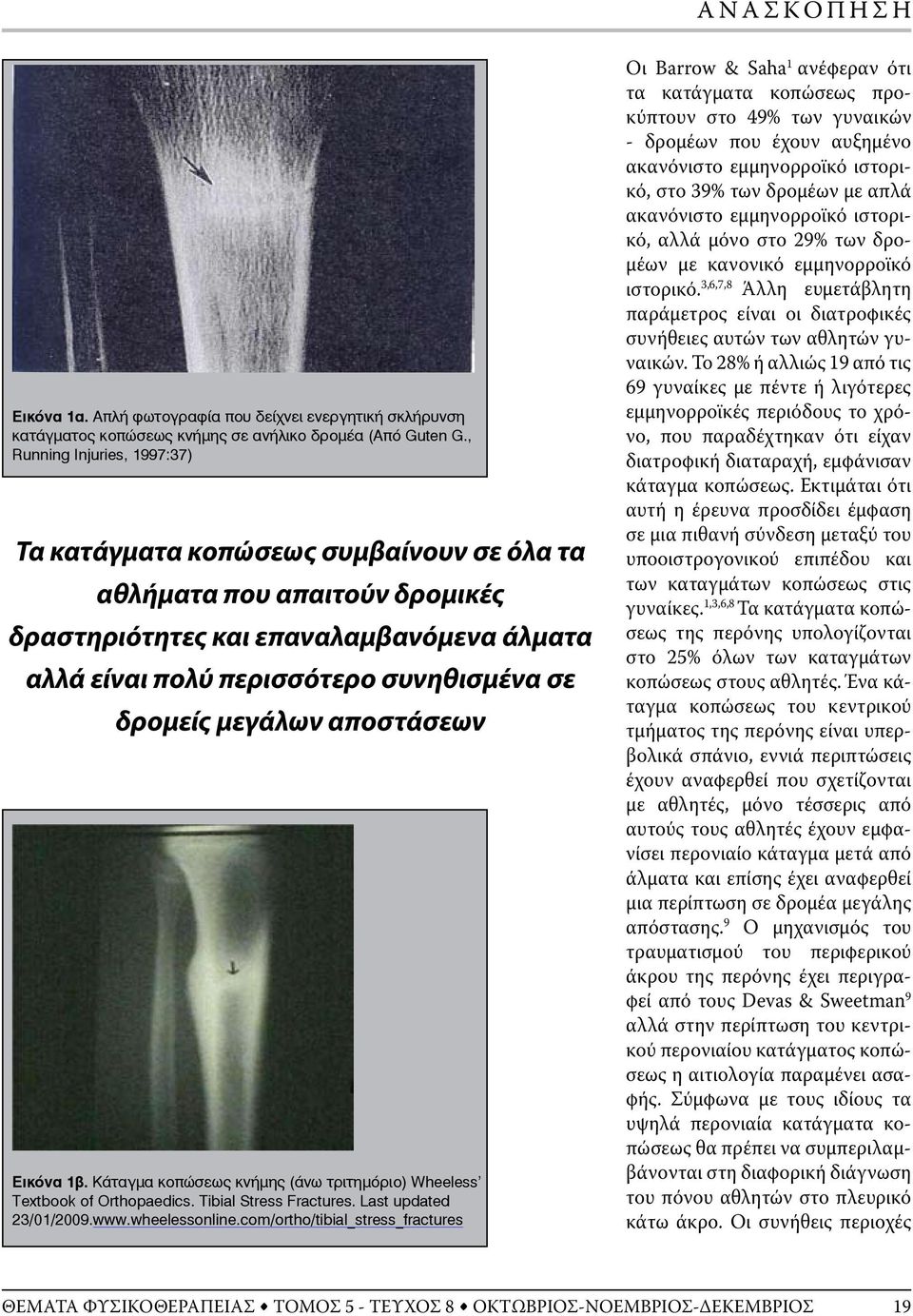 μεγάλων αποστάσεων Εικόνα 1β. Κάταγμα κοπώσεως κνήμης (άνω τριτημόριο) Wheeless Textbook of Orthopaedics. Tibial Stress Fractures. Last updated 23/01/2009.www.wheelessonline.