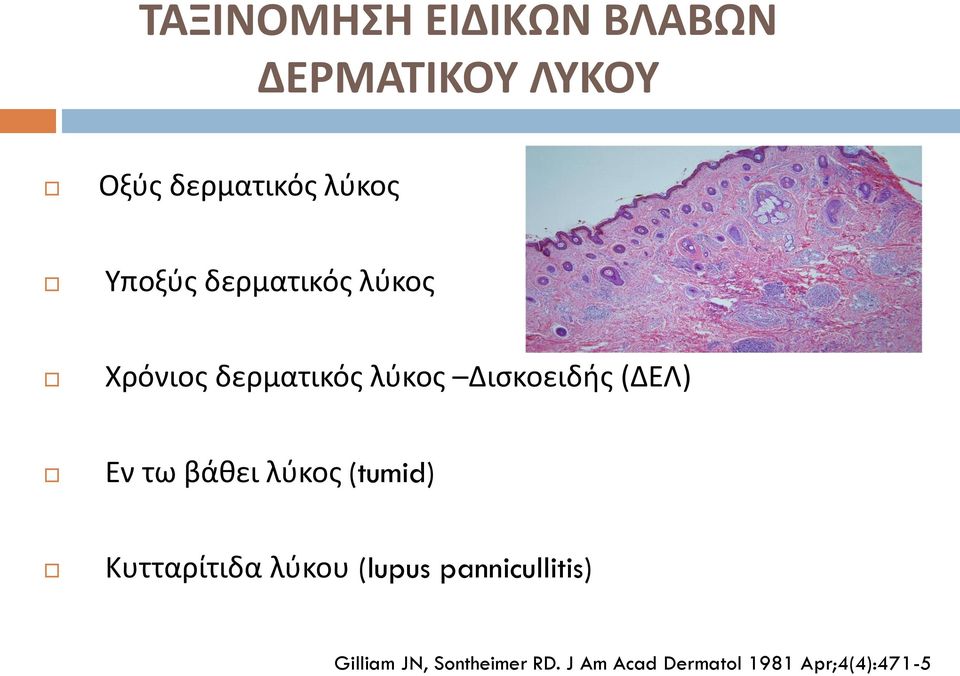 Εν τω βάθει λύκος (tumid) Κυτταρίτιδα λύκου (lupus pannicullitis)