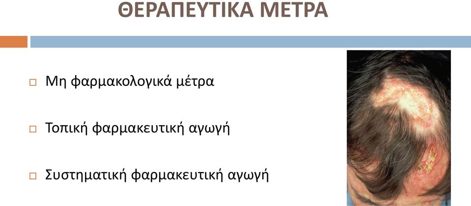 Τοπική φαρμακευτική
