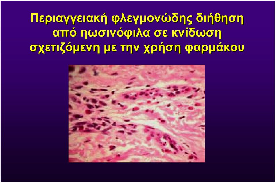 από ηωσινόφιλα σε