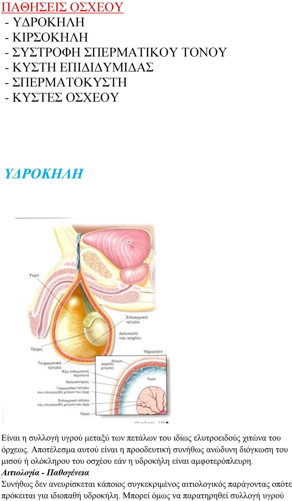 Αποτέλεσμα αυτού είναι η προοδευτική συνήθως ανώδυνη διόγκωση του μισού ή ολόκληρου του οσχέου εάν η υδροκήλη είναι