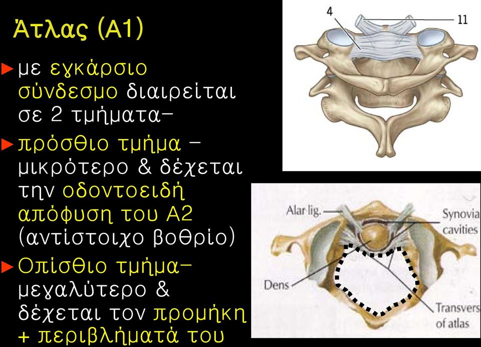 οδοντοειδή απόφυση του Α2 (αντίστοιχο βοθρίο)