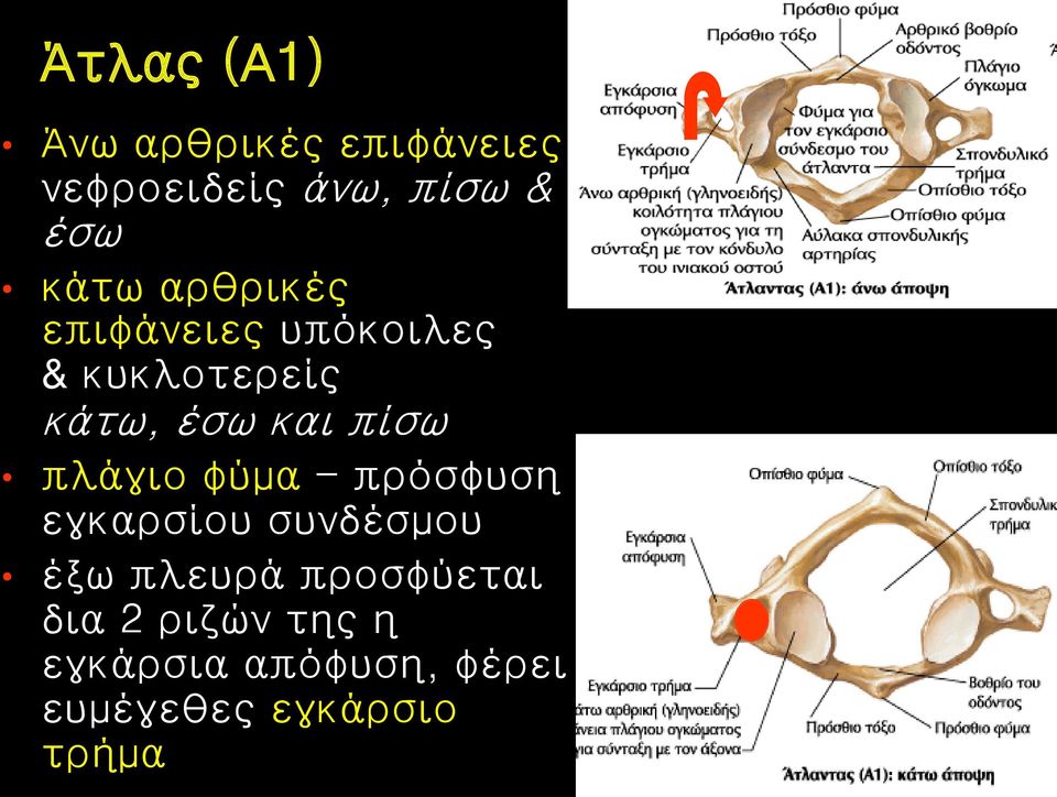 πίσω πλάγιο φύμα - πρόσφυση εγκαρσίου συνδέσμου έξω πλευρά