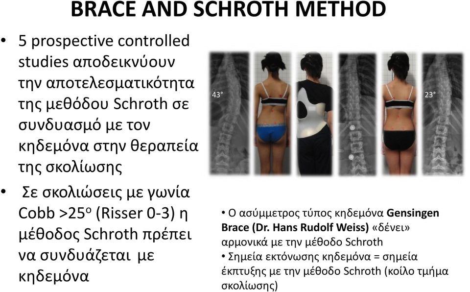 Schroth πρέπει να συνδυάζεται με κηδεμόνα Ο ασύμμετρος τύπος κηδεμόνα Gensingen Brace (Dr.