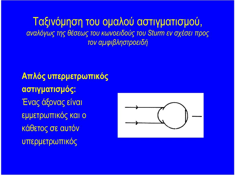 αµφιβληστροειδή Απλός υπερµετρωπικός αστιγµατισµός: