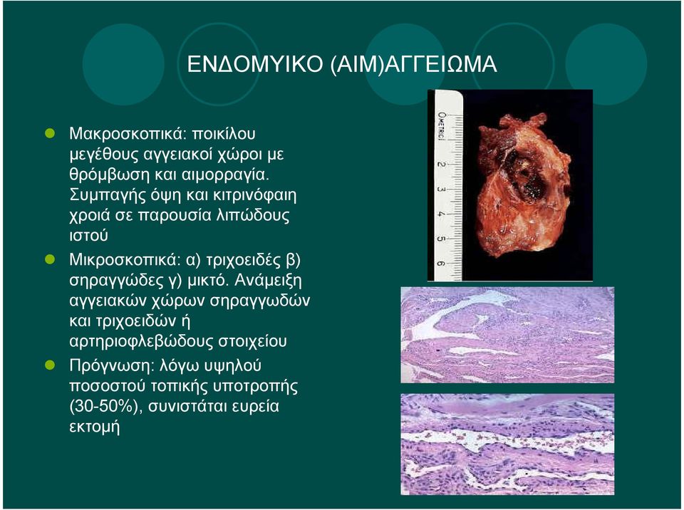 Συµπαγής όψη και κιτρινόφαιη χροιά σε παρουσία λιπώδους ιστού Μικροσκοπικά: α) τριχοειδές β)