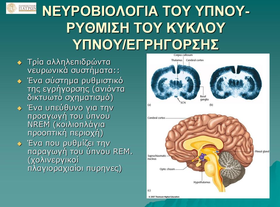 σχηματισμό) Ένα υπεύθυνο για την προαγωγή του ύπνου NREM (κοιλιοπλάγια προοπτική