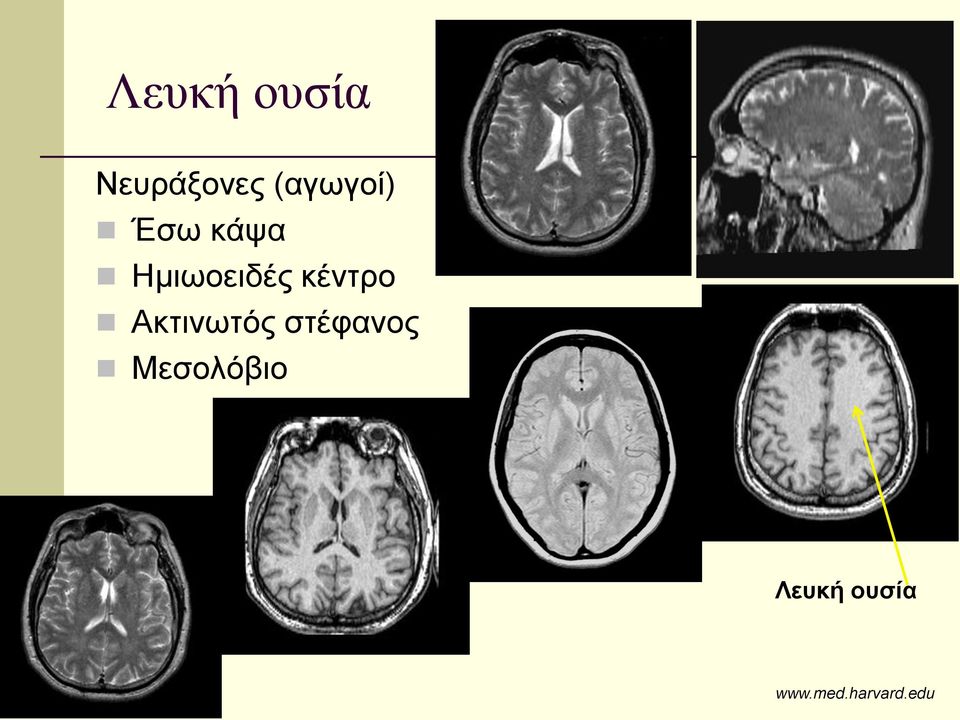 κέντρο Ακτινωτός στέφανος