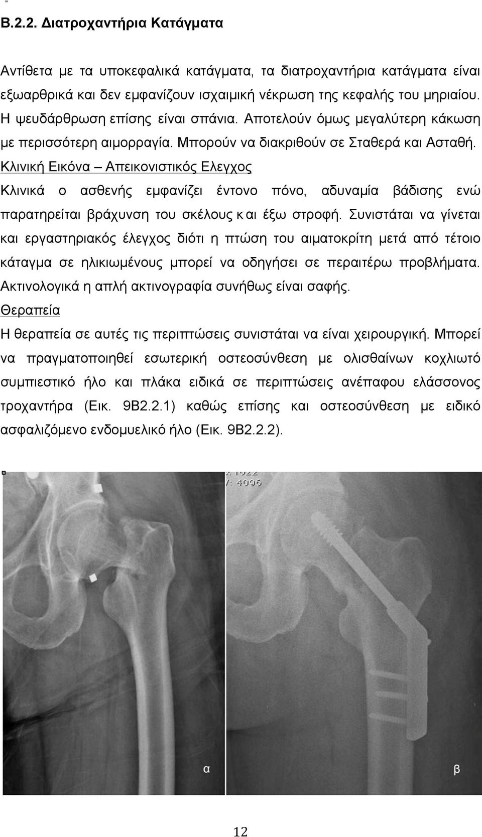 Κλινική Εικόνα Απεικονιστικός Ελεγχος Κλινικά ο ασθενής εµφανίζει έντονο πόνο, αδυναµία βάδισης ενώ παρατηρείται βράχυνση του σκέλους κ αι έξω στροφή.