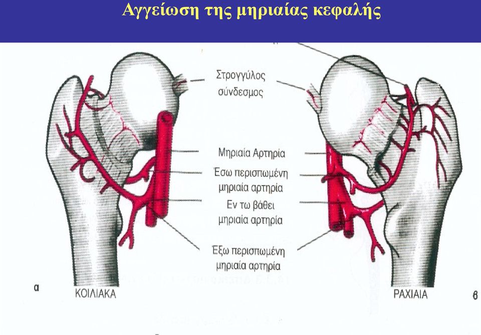 μηριαίας