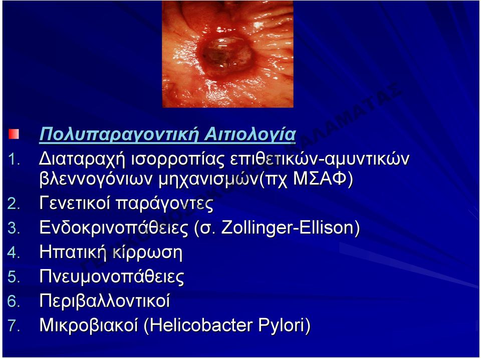 μηχανισμών(πχ ΜΣΑΦ) 2. Γενετικοί παράγοντες 3. Ενδοκρινοπάθειες (σ.