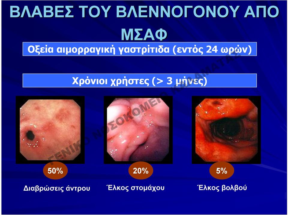 Χρόνιοι χρήστες (> 3 μήνες) 50% 20% 5%