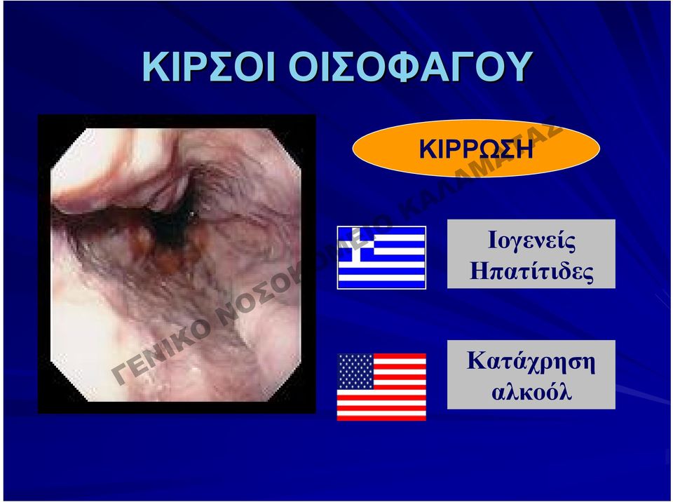 ΚΙΡΡΩΣΗ
