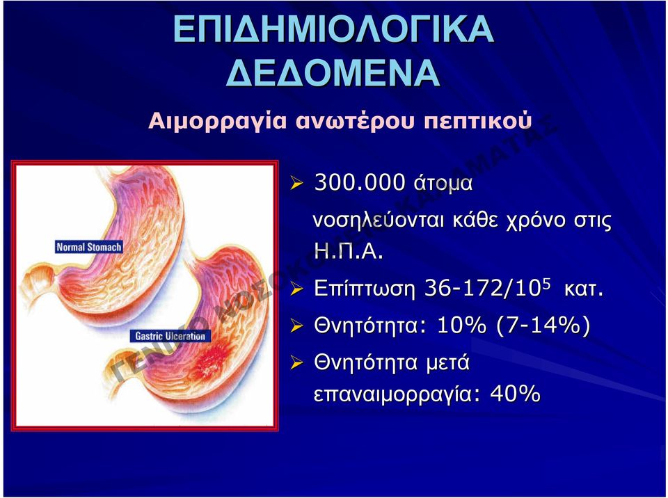 000 άτομα νοσηλεύονται κάθε χρόνο στις Η.Π.Α.