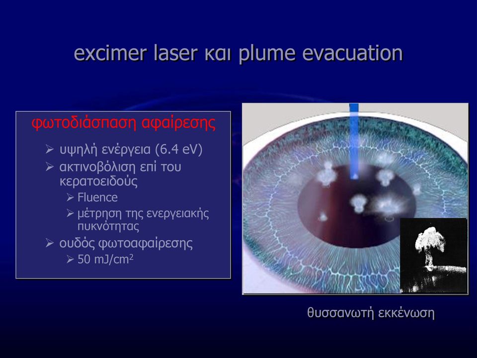 4 ev) ακτινοβόλιση επί του κερατοειδούς Fluence