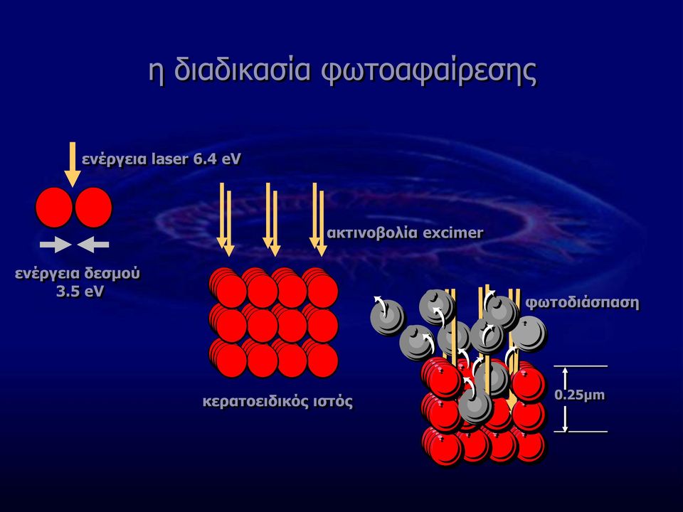 4 ev ακτινοβολία excimer