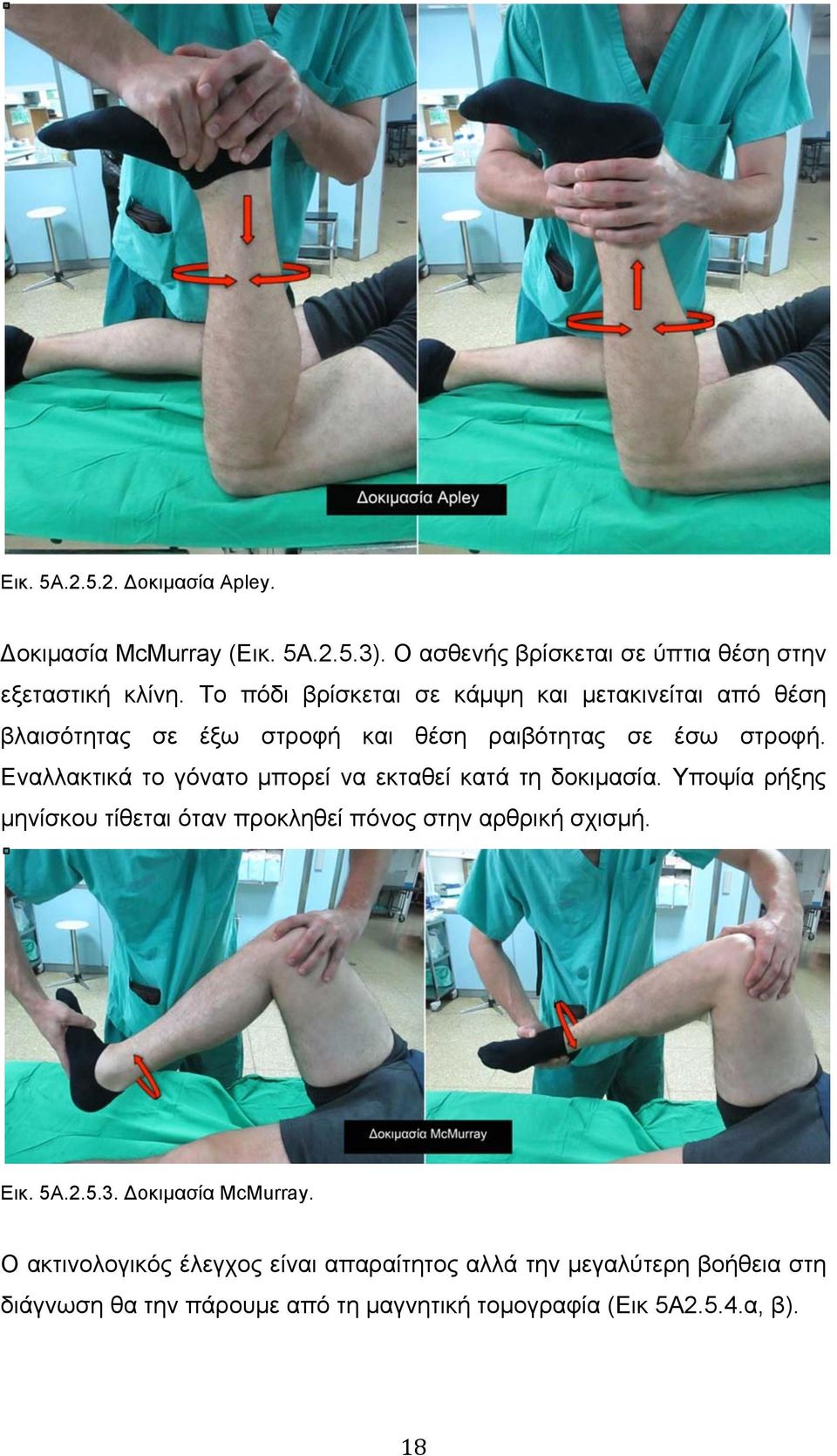 Εναλλακτικά το γόνατο µπορεί να εκταθεί κατά τη δοκιµασία. Υποψία ρήξης µηνίσκου τίθεται όταν προκληθεί πόνος στην αρθρική σχισµή. Εικ. 5Α.