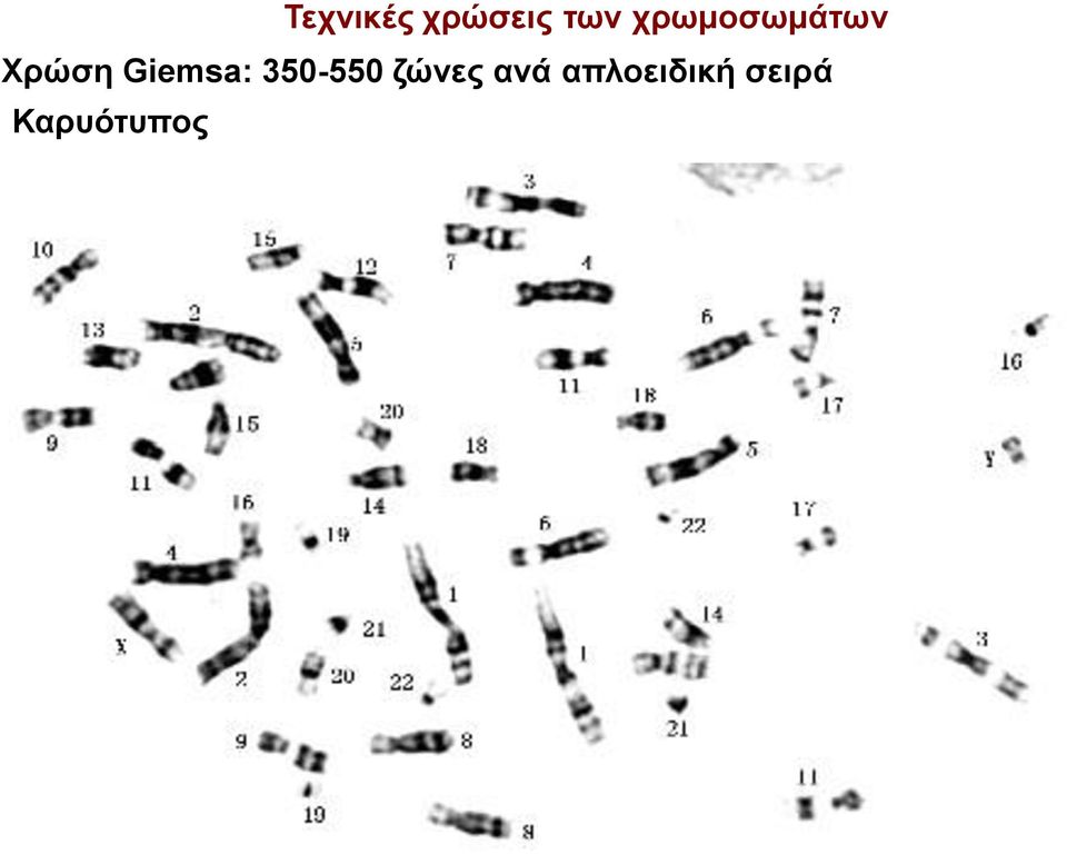 Giemsa: 350-550 ζώνες