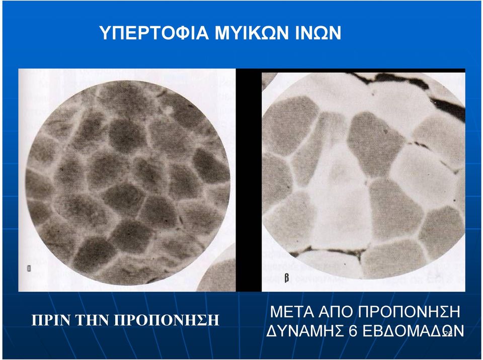 ΠΡΟΠΟΝΗΣΗ ΜΕΤΑ ΑΠΟ