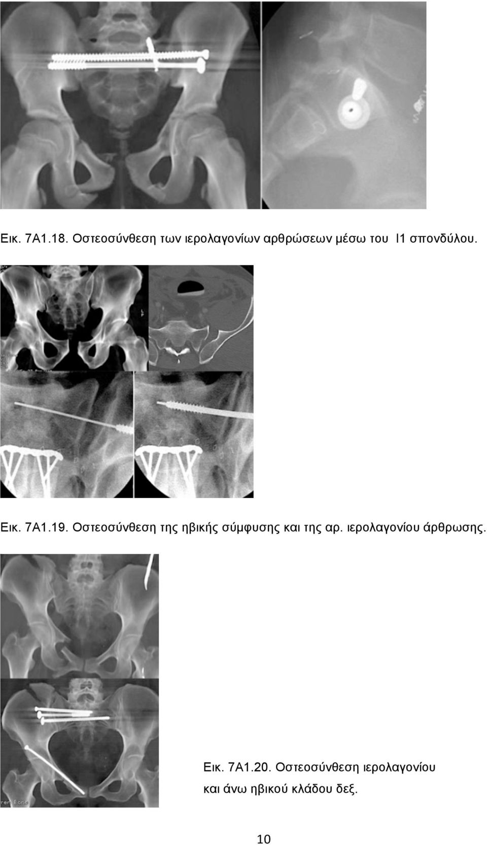 σπονδύλου. Εικ. 7Α1.19.
