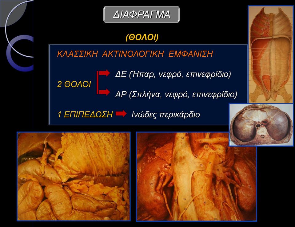 νεφρό, επινεφρίδιο) 2 ΘΟΛΟΙ ΑΡ