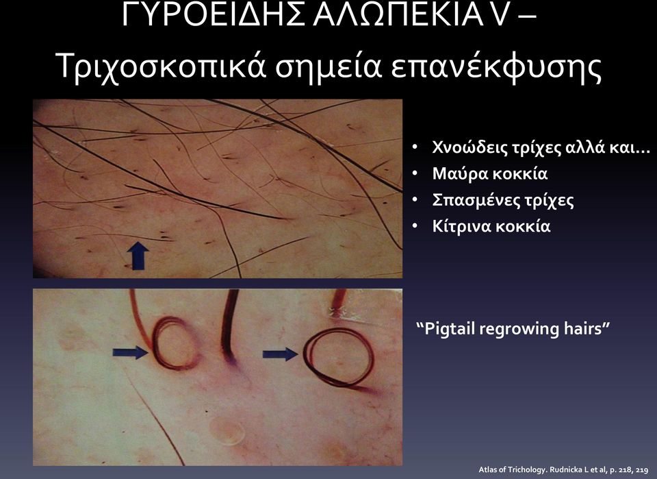 .. Μαύρα κοκκία Σπασμένες τρίχες Κίτρινα κοκκία